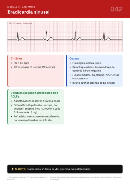 Página do guia de mapas de ECG