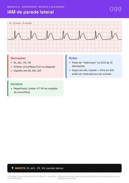 Página do guia de mapas de ECG