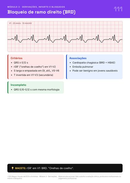 Página do guia de mapas de ECG