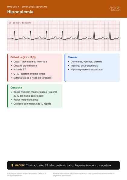 Página do guia de mapas de ECG