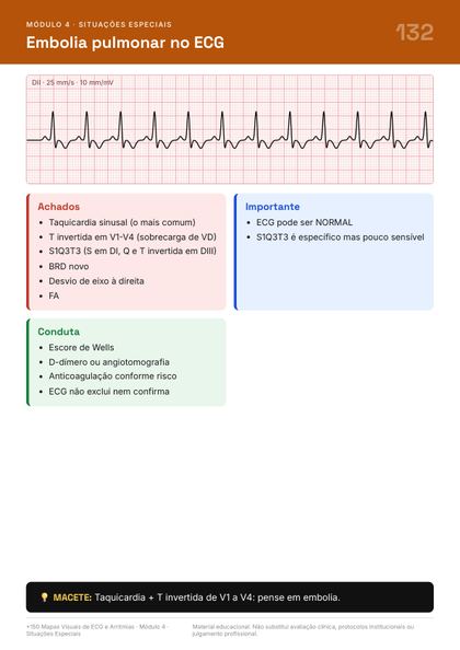 Página do guia de mapas de ECG