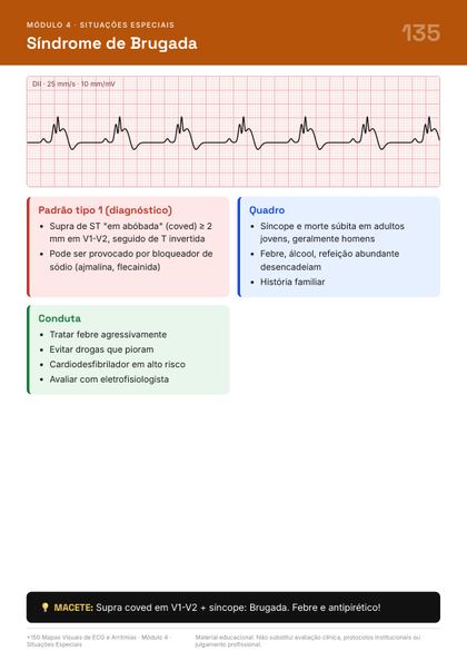 Página do guia de mapas de ECG